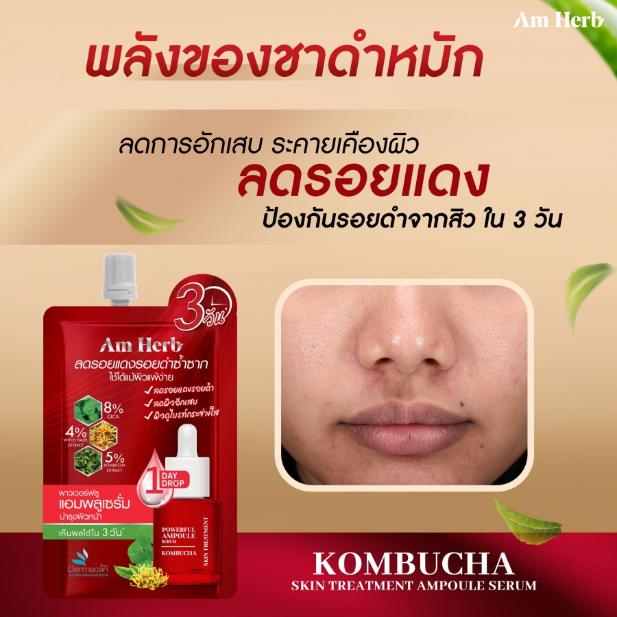 AMHERB Powerful Kombucha Skin Treatment Ampoule Serum